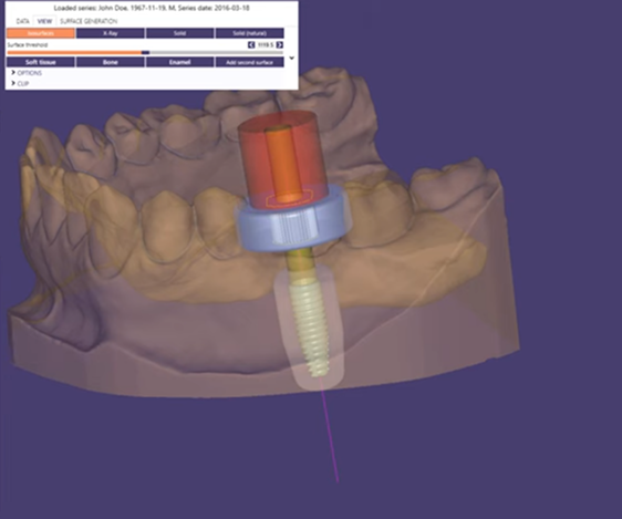 Dental 3D model